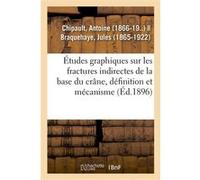 Études graphiques sur les fractures indirectes de la base du crâne, définition et mécanisme Antoine Chipault (Auteur)