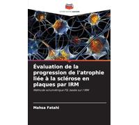 Évaluation de la progression de l'atrophie liée à la sclérose en plaques par IRM