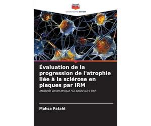 Évaluation de la progression de l'atrophie liée à la sclérose en plaques par IRM