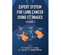 Expert System for Lung Cancer Using CT Images - Volume 1: Application of Medical Image processing for Expert Systems