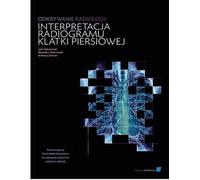 Exploration de l'interprétation radiologique de la radiographie du thorax