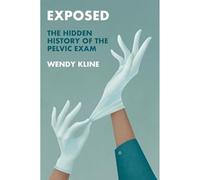 Exposed: The Hidden History of the Pelvic Exam