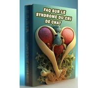 FAQ sur le syndrome du cri de chat: Trouvez des réponses à la FAQ sur le syndrome du cri de chat - une maladie génétique rare chez les nourrissons!