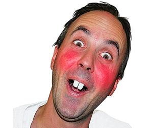 FAUSSES DENTS DE LAPIN