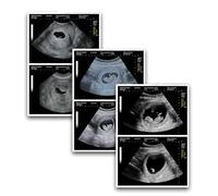 Faux échographie de grossesse - Photo drôle - Article de farce - Photos réalistes - Cadeau amusant pour les couples, mari, épouse, partenaire, surprise, plaisir