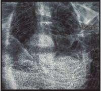 Fear Falls Burning - Birchville Cat Motel [Import]