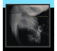 Fear Falls Burning / Nadja - Fear Falls Burning / Nadja