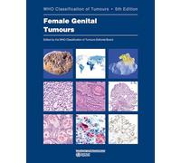 Female Genital Tumours: Who Classification of Tumours