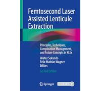 Extraction de lenticule au laser femtoseconde – Principes et techniques – Mise à jour