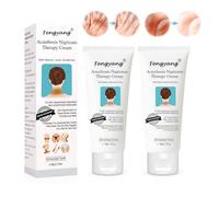 Fengyang® 2Pcs Crème Acanthosis Nigricans, Crème Anti-taches Foncées, Crème Correctrice Taches Noires, Élimination de l'hyperpigmentation pour l'articulation du coude, du genou