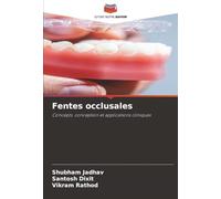 Fentes occlusales: Concepts, conception et applications cliniques