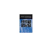 Fetal Cardiology Simplified: A Practical Manual
