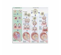 Fetal Development Twin Placentation Explained Chart Poster OBGYN Clinic Waiting Room Decor Science Medicine Canvas Print for Teaching