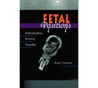 Fetal Positions by Karen Newman Karen Newman (Auteur)