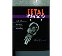 Fetal Positions by Karen Newman Karen Newman (Auteur)