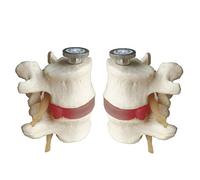 FHUILI 2 PCS Modèle de la Colonne Lombaire Humaine - Modèle éducatif 2 Section Lumbare Anatomical Modèle Anatomique Disc Lombaire médical pour l'aide à la Formation en éducation médicale,A