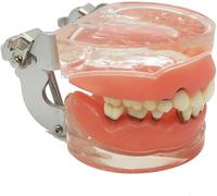 FHUILI Les Maladies parodontales - Modèle d'étude Dents dentaires Modèle d'enseignement - Tartre Cure Model - Simulation des Dents Oral Typodont Dents Modèle - Étude pour l'enseignement,A