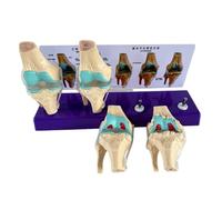 FHUILIJH Blanc,Life Size, Modèle de démonstration des lésions osseuses du Genou Modèle Humain de la pathologie du Genou pour l'étude orthopédique des articulations Enseignement et Affichage
