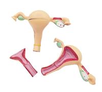 FHUILIJH Flesh,18cm, Modèle Anatomique d'utérus et d'ovaires 2 pièces Modèle Vaginal féminin pathologique pour l'enseignement et la Recherche en Anatomie médicale