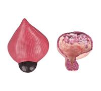 FHUILIJH Modèle Anatomique de vessie Saine et de vessie pathologique Modèle de démonstration Comparative de vessie à Tube Amovible,Flesh,20cm