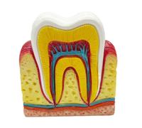 FHUILIJH Modèle d'affichage de Section transversale de dent Six Fois Plus Grand - Modèle d'enseignement Oral du Nerf Dentaire - pour l'affichage de l'étude de l'enseignement,Flesh,8cm