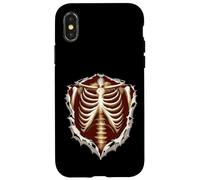 Fie How My Bones Ache Nurse Romeo Juliette Citation Humour Coque pour iPhone X/XS