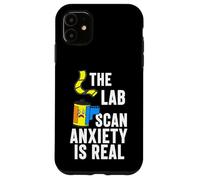 Film Photography The Lab Scan Anxiety is Real Analog Coque pour iPhone 11