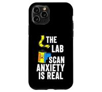 Film Photography The Lab Scan Anxiety is Real Analog Coque pour iPhone 11 Pro