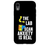 Film Photography The Lab Scan Anxiety is Real Analog Coque pour iPhone XR