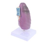 FIXOSHEE Modèle Anatomique Pulmonaire Éducatif Modèle Pulmonaire Pathologique pour Enseignement Physiologie et Anatomie Outil Pédagogique Simple pour Étudiants et Professionnels