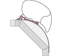 Flamme 98655698 Kit de Supports