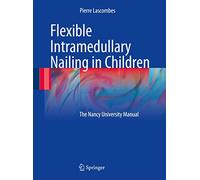 Flexible Intramedullary Nailing in Children: The Nancy University Manual