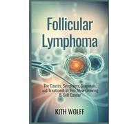 Follicular Lymphoma: The Causes, Symptoms, Diagnosis, and Treatment of This Slow-Growing B-Cell Cancer