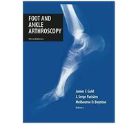 Foot And Ankle Arthroscopy