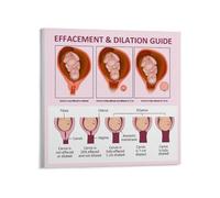 FOPURE Anatomy Chart Poster Womens Health Canvas Print Wall-Art for Clinic Office Decor(Framed,16x24inch(40x60cm))