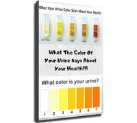 FOPURE Health Indicator Chart Urine Color Guide Informative Poster for Bathroom Decor Wellness Self Care Home Office