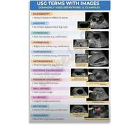 FOPURE Ultrasound Terminology Guide Poster with Images Sonography Reference Chart Educational Wall-Art for Clinic Student Doctor Office(Framed,12x18inch(30x45cm))