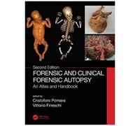 Forensic And Clinical Forensic Autopsy