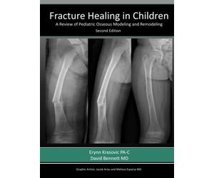 Fracture Healing in Children: A Review of Pediatric Osseous Modeling and Remodeling Second Edition