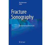 Fracture Soonografie: A Comprehensive Clinical Guide