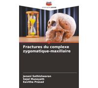 Fractures du complexe zygomatique-maxillaire