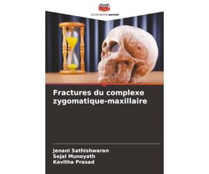Fractures du complexe zygomatique-maxillaire