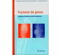 Fractures du genou - Collectif - Springer Vienne - broché - Scolaire / Universitaire