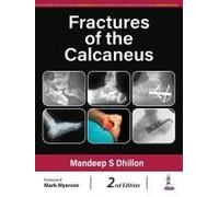 Fractures Of The Calcaneus