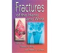 Fractures of the Hand And Wrist