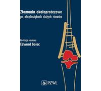 Fractures périarticulaires après alloplasties de grosses articulations