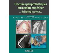 Fractures périprothétiques du membre supérieur...de l'épaule au pouce...