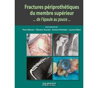 Fractures périprothétiques du membre supérieur...de l'épaule au pouce... - Laurent Obertone - Sauramps Medical - broché - Scolaire / Universitaire