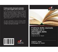Fratture Della Clavicola Trattate Con Il Placcaggio Della Clavicola