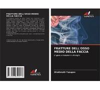 Fratture Dell'osso Medio Della Faccia